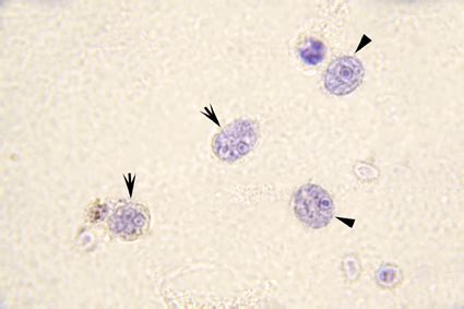 Endolimax nana parasite (Trophozoite and Cyst) | Medical Laboratories