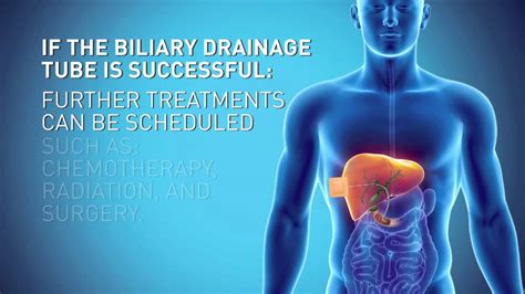 Biliary Drain - YouTube