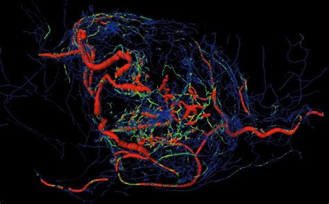 Angiogenesis of tumors, its history