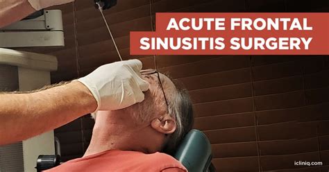 What Are the Surgical Options for Acute Frontal Sinusitis?