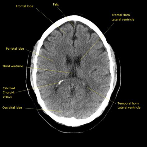 Neurovascular Medicine