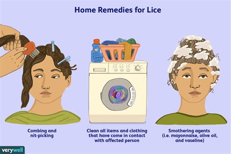 Outrageous Tips About How To Cure Head Lice - Feeloperation