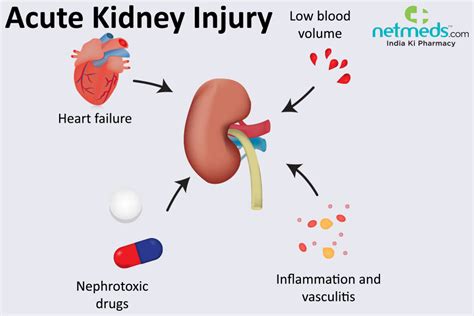 Acute Kidney Failure: Causes, Symptoms and Treatment