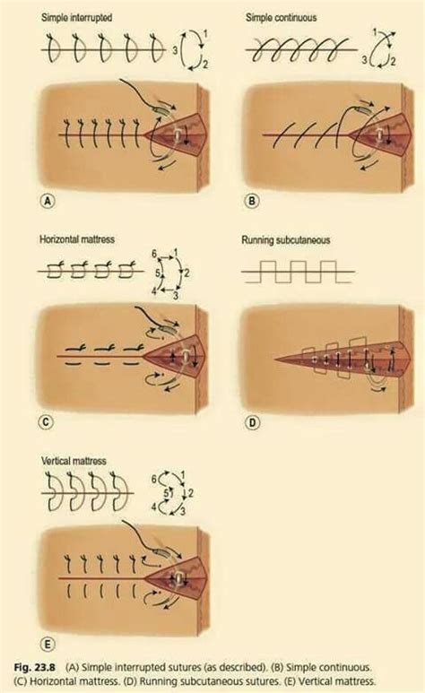 Pin by D.H. Williamson on My Stuff | Vet medicine, Surgical nursing ...