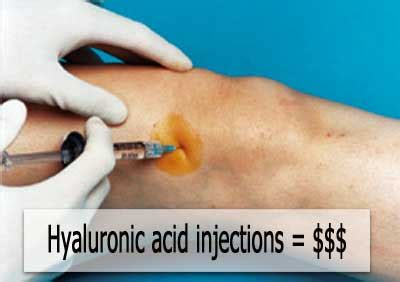 How Effect Are Hyaluronic Acid Injections for Relieving Knee Pain ...