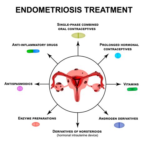 Endometriosis And Its Treatment