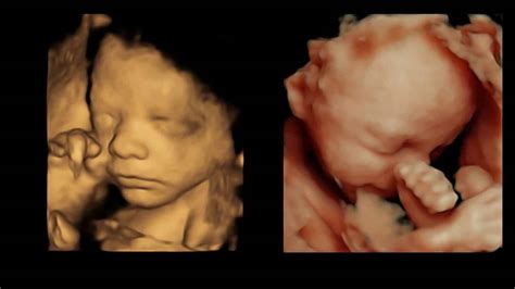 Our 3D/4D Scan Explained - Window to the Womb