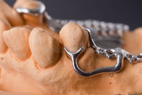 Dental wax model stock photo. Image of denture, molars - 17692614