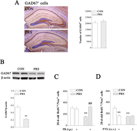 The deficiency of glutamic acid decarboxylase 67 (GAD67) protein is ...