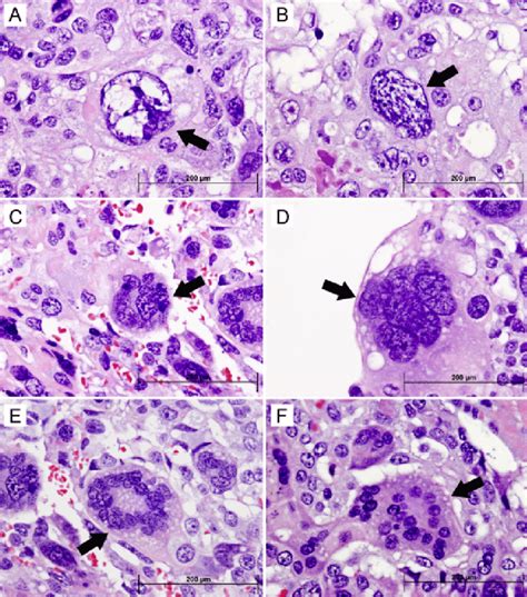 Cancer Cell Histology