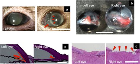 Comparison of an elevated IOP eye (right) and a normal eye (left), and ...