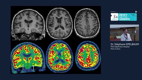 Pet Brain Scan