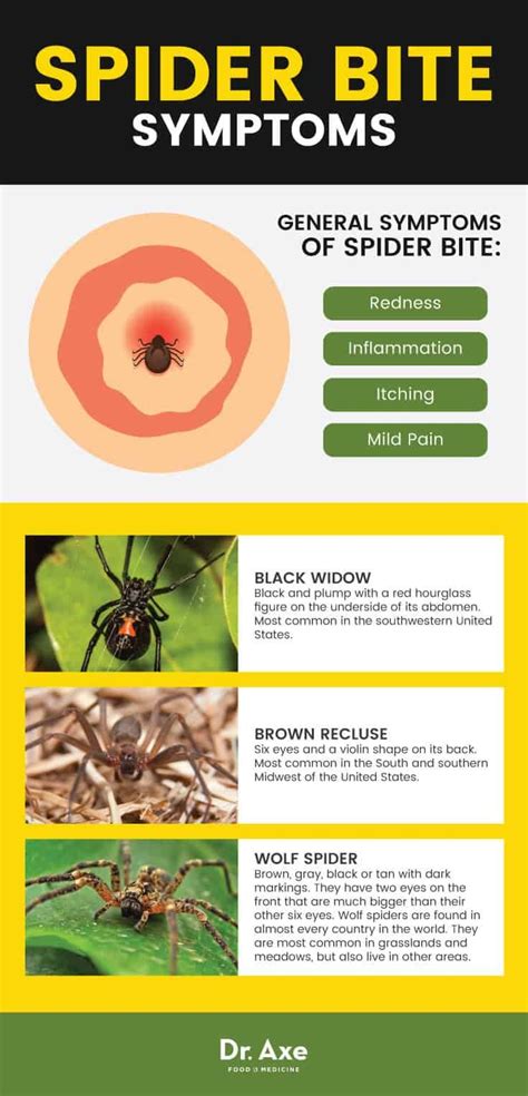 House Spider Bite Identification Chart