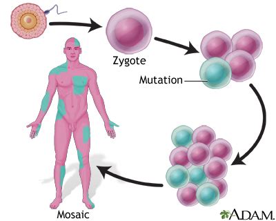 Mosaicism Information | Mount Sinai - New York