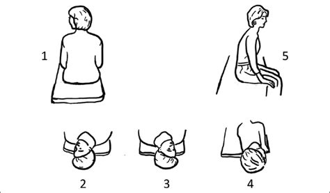 Schematic drawing of the Epley liberation maneuver in a patient with ...