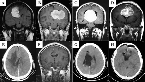 A proposed scheme for the classification and surgical planning of ...