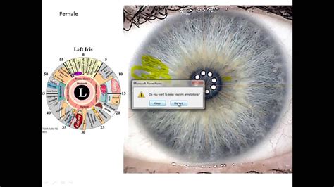 Iridology Review- How To Read Your Eyes For Health | Iridology, Eye ...