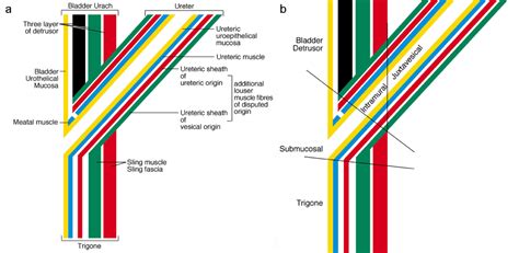 Functional Anatomy of the Vesicoureteric Junction: Implication on the ...