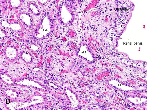 Collecting Ducts Kidney Histology