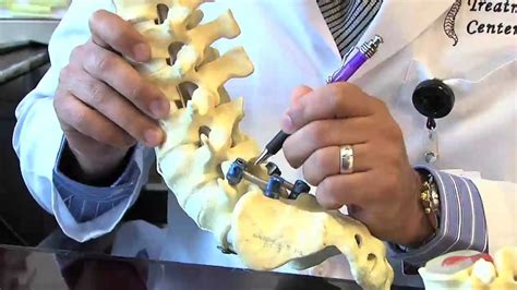 Surgical Procedures - Lumbar Laminectomy & Discectomy - YouTube