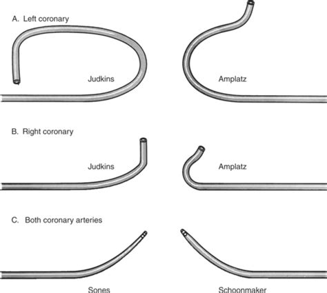 Cardiac Angiography | Radiology Key