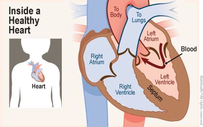 Patent Foramen Ovale (PFO) (for Parents) - Rady Children's Hospital (XML)