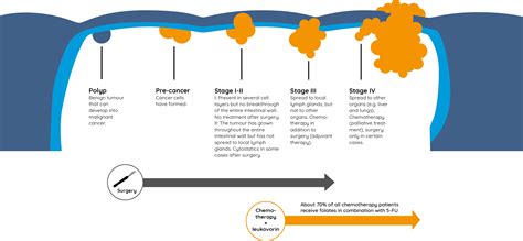 Colorectal Cancer Progression