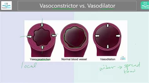 [What's the difference] Vasoconstriction vs. Vasodilation - YouTube