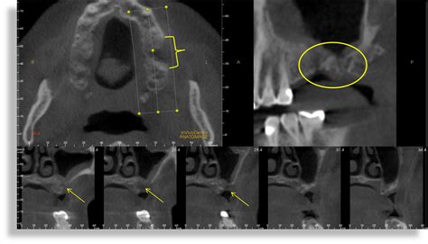 Dental X-Rays | Ask Dr. G