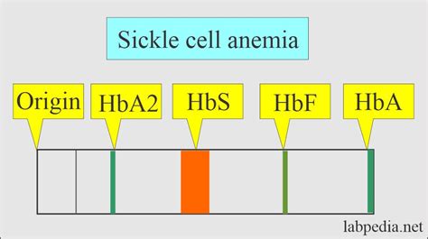 Hemoglobin:- Part 2 - Hemoglobin Electrophoresis, (Hb electrophoresis ...