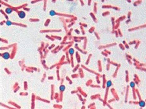 a. Spores and bacteria of Clostridium tetani with a typical drum-stick ...