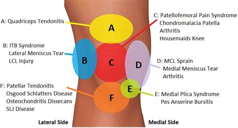 Anterior Treatment Pain Knee