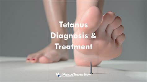 Best Diagnosis and Treatment for Tetanus in the Philippines - Medical ...