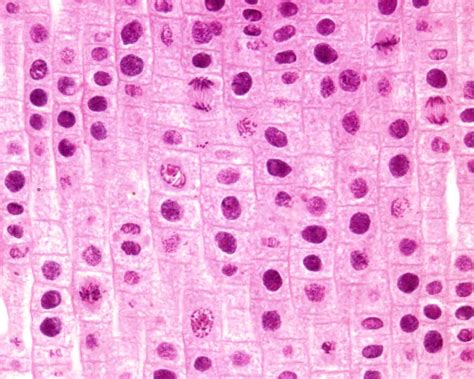 Stages Of Mitosis Under The Microscope Mitosis