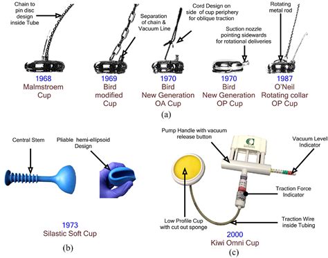 An engineering perspective of vacuum assisted delivery devices in ...