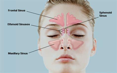 Sinus surgery with no cuts | Sinusitis & sinus surgery in Gurgaon