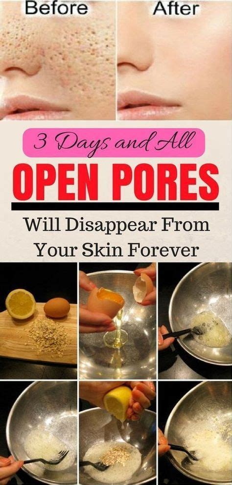 How To Close The Pores On Face Home Remedies - Grizzbye