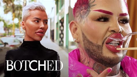 Botched Has More Work to Be UNDONE - New Season Aug. 3 | Botched | E ...