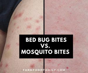 Bed Bug Bites vs. Mosquito Bites: Similarities and Differences (Photos)