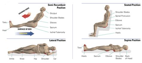 Semirecumbent Position