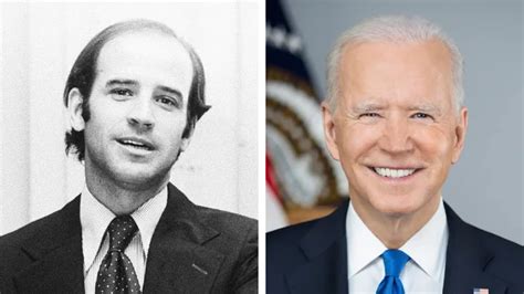 Joe Biden Hair Transplant - Hair Transplant TR