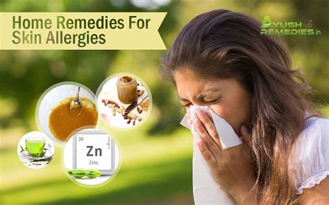 7 Best Home Remedies for Skin Allergies - Get Marvellous Results!