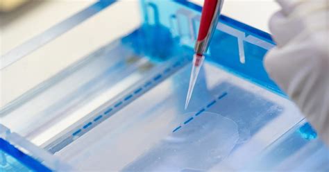 Gel Electrophoresis Explained - Modern Biology Inc