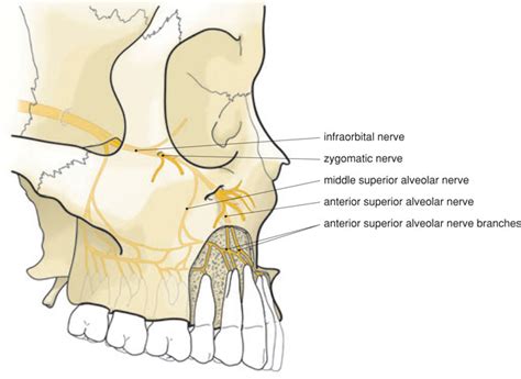 5 Local anaesthesia in the upper jaw | Pocket Dentistry