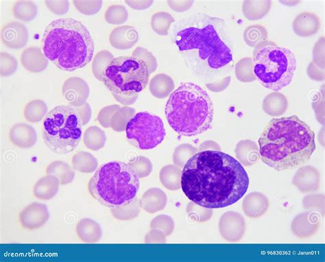 White blood cells stock photo. Image of research, leukemia - 96830362