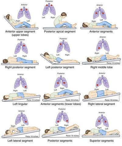 16 Mucus Clearing Techniques That Alleviate Shortness of Breath