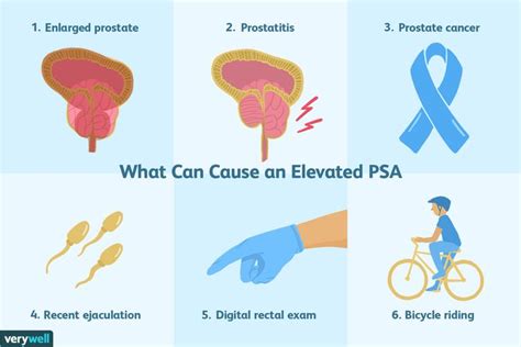 Pin on Prostate Cancer