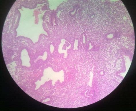 Ganglion Cells Histology