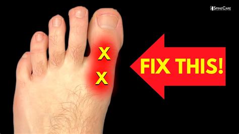 How To Self Adjust Your Big Toe | eduaspirant.com