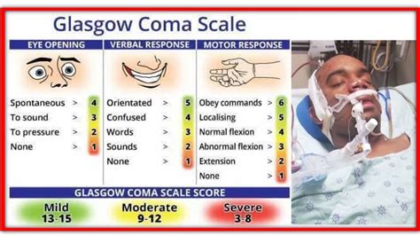 Easy Way To Learn Glasgow Coma Scale | How To Learn Glasgow Coma Scale ...